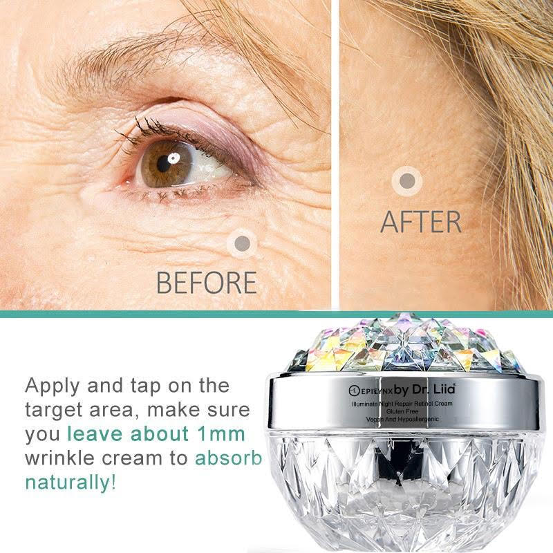 Anti-Aging Retinol Night Moisturizer – Hydrating, Vegan, Gluten-Free &